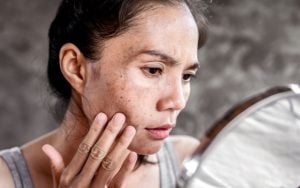 Substance Abuse Impact on Skin